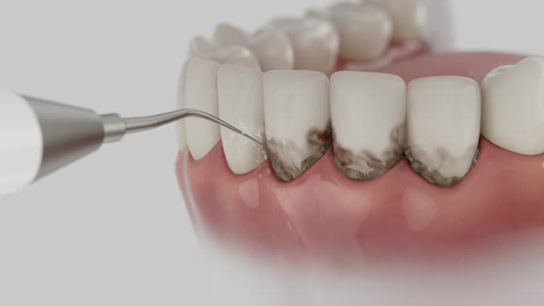 Reliable Dental Implants contractor in Calcutta, OH by Smile Center Dentistry